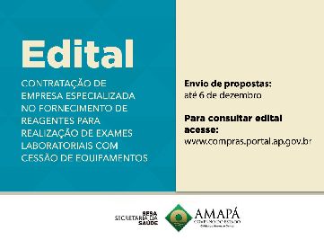 notícia: Licitação busca contratação de empresa para fornecimento de reagentes para laboratório