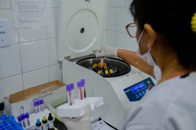 notícia: No Amapá, laboratório do HE realiza em média mil exames diários