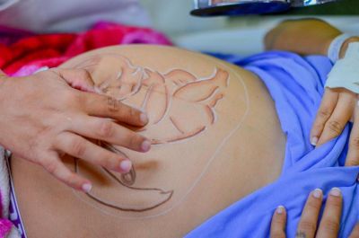 notícia: Mais de 18% dos bebês nascidos no Amapá foram gerados por mães adolescentes, em 2022