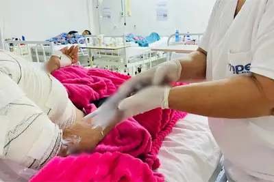 notícia: Governo do Amapá alerta para riscos e reforça importância da prevenção sobre queimaduras por choque elétrico