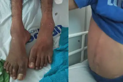 notícia: UPA Zona Norte promove campanha de conscientização sobre abandono de incapaz nas unidades de saúde