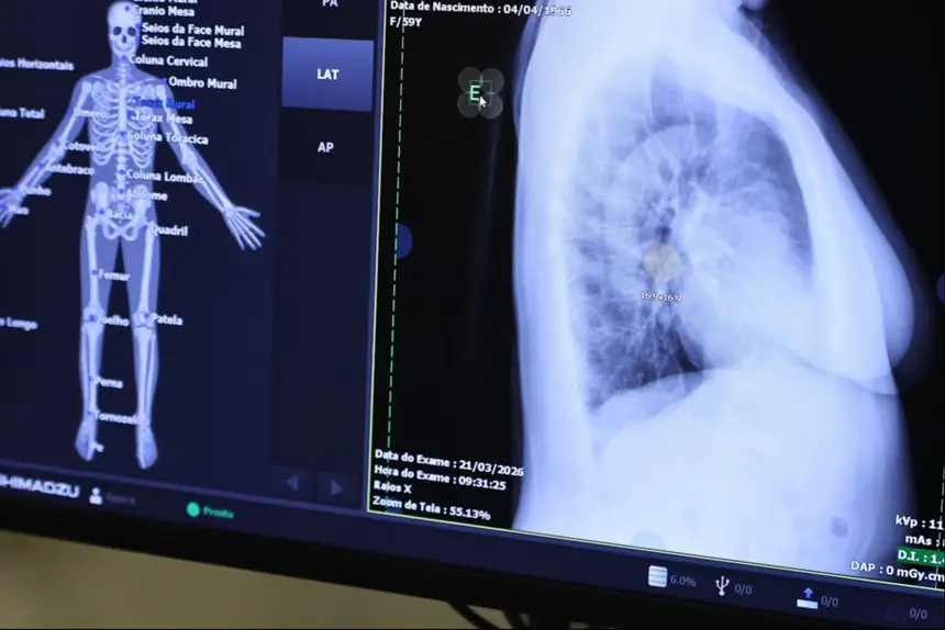 A parceria fimada entre governo do Amapá e HU foi possível adquirir modernos equipamentos 