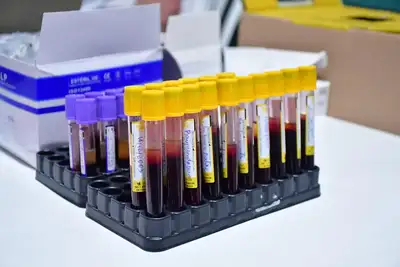 notícia: Governo do Amapá garante exames laboratoriais para candidatos do concurso da PM no Hospital de Clínicas Alberto Lima