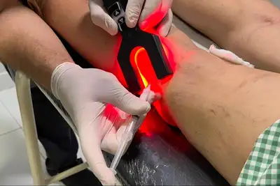 notícia: Saúde do Amapá reforça alerta para sinais de doenças vasculares na população