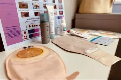 notícia: Governo do Amapá garante assistência especializada e tecnologia de ponta a pacientes ostomizados no Creap